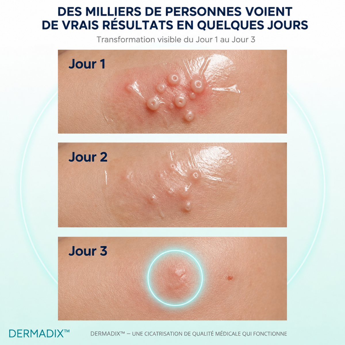 DERMADIX ™