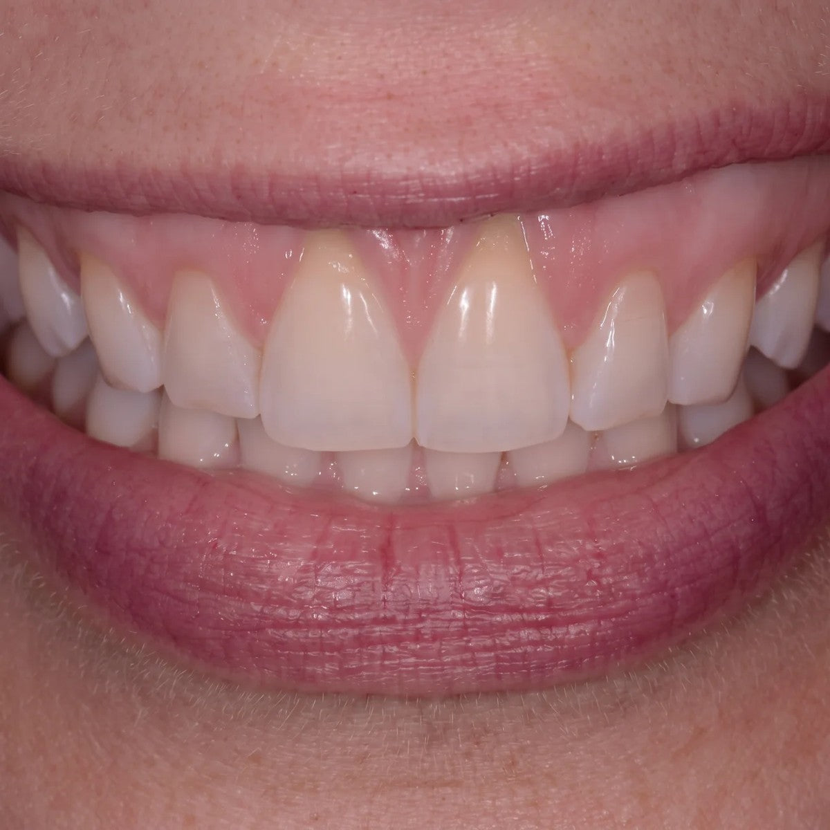 Son dentiste a demandé ce qui avait changé