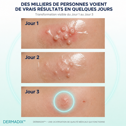 DERMADIX ™