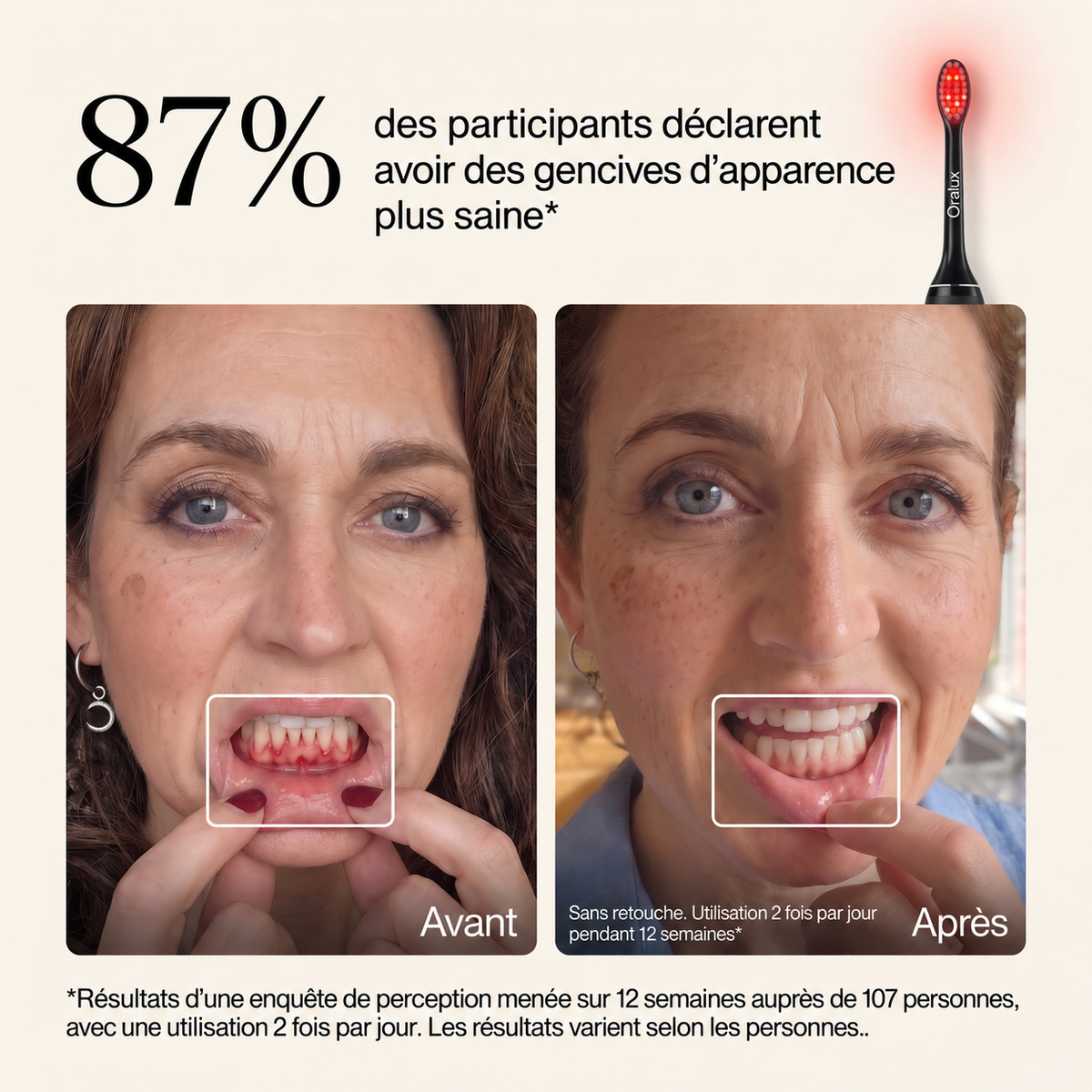 Oralux ™-Brosse à dents réparatrice pour gencives