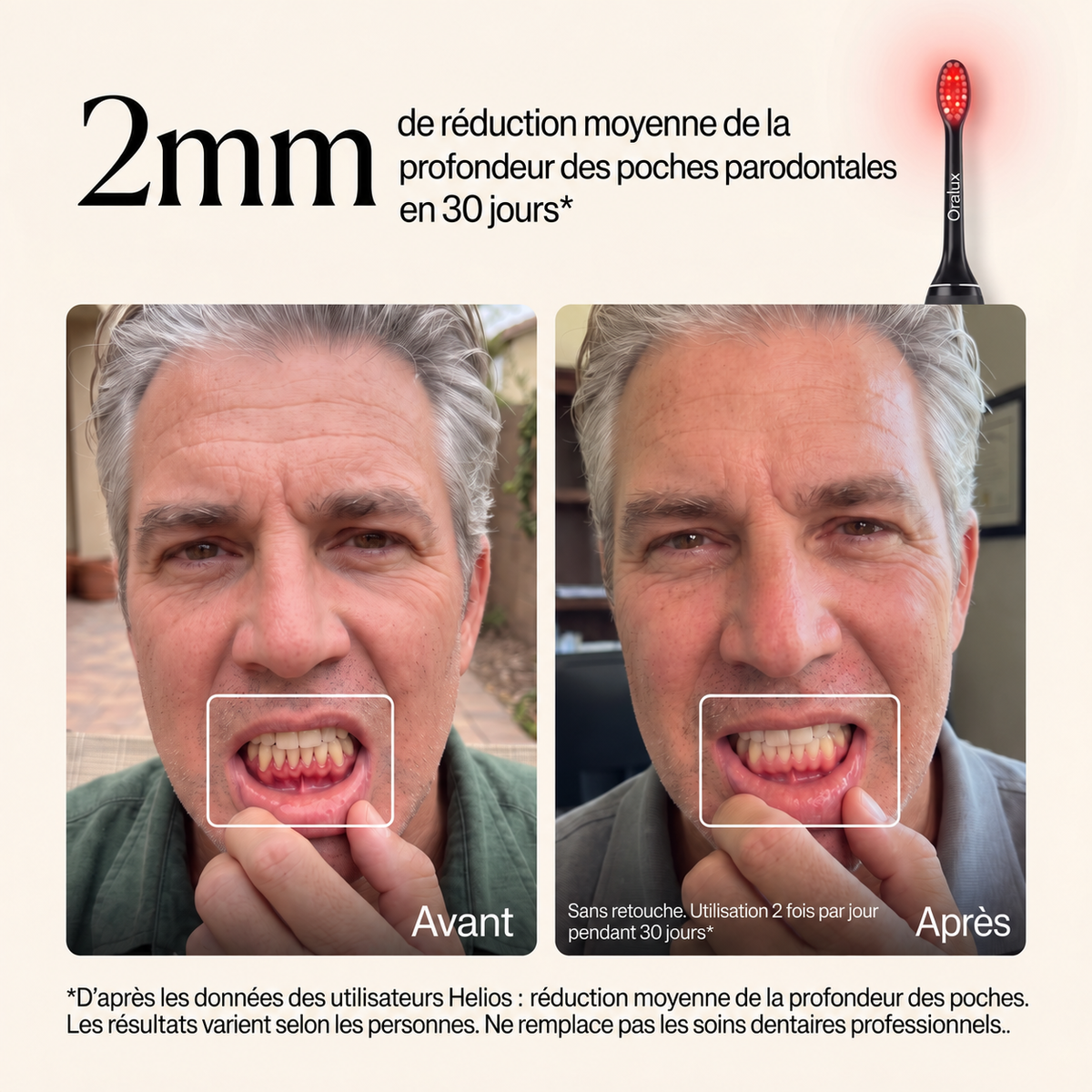 Oralux ™-Brosse à dents réparatrice pour gencives