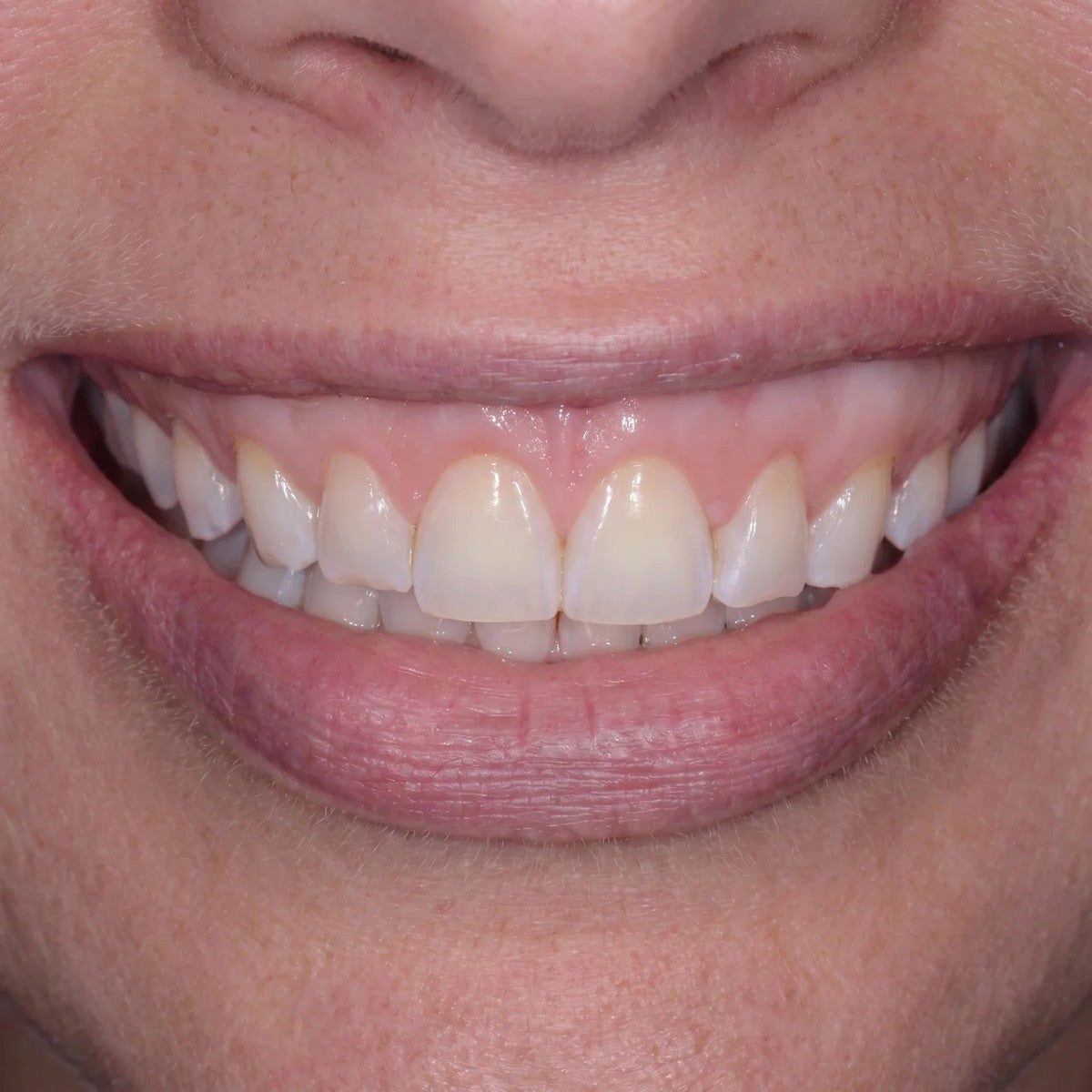 Son dentiste a demandé ce qui avait changé